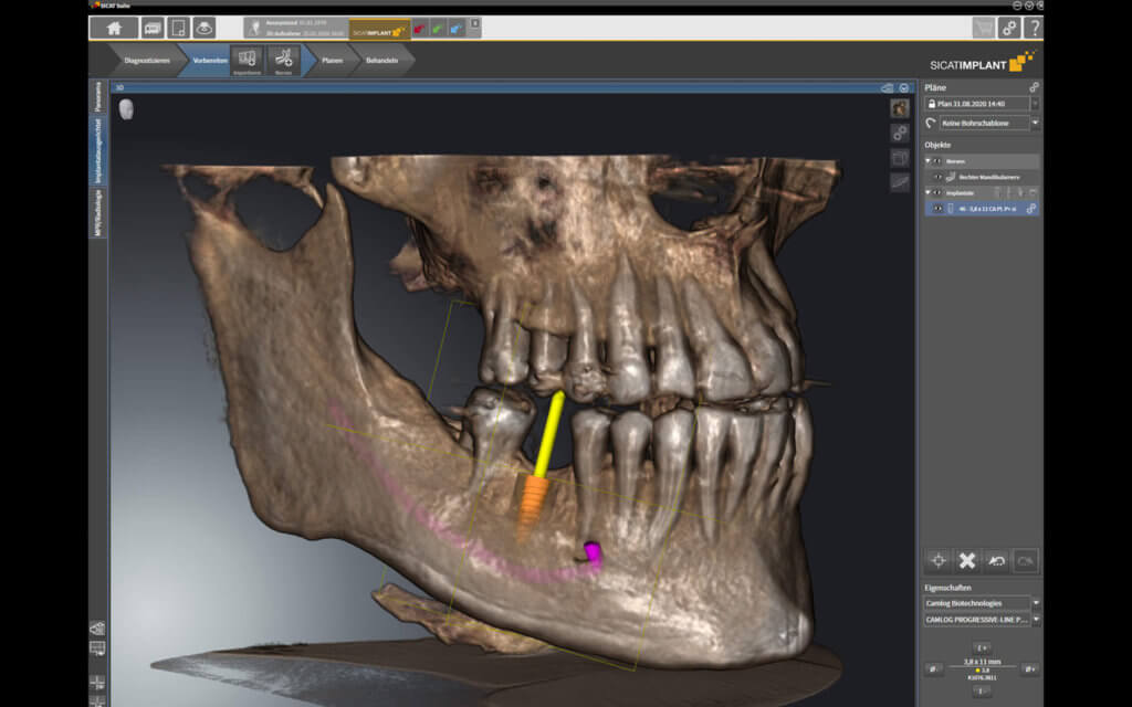 everydent-durr-dental-vistasoft-ai-01