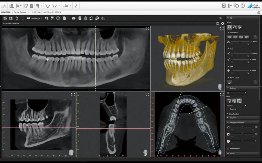 everydent-durr-dental-vistasoft-ai-02