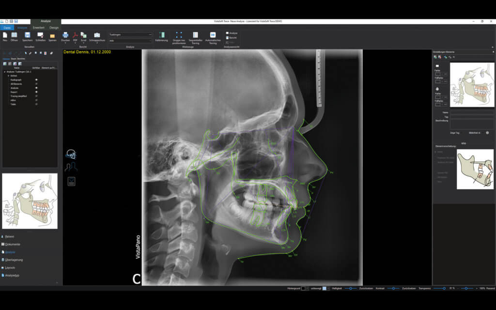 everydent-durr-dental-vistasoft-ai-03