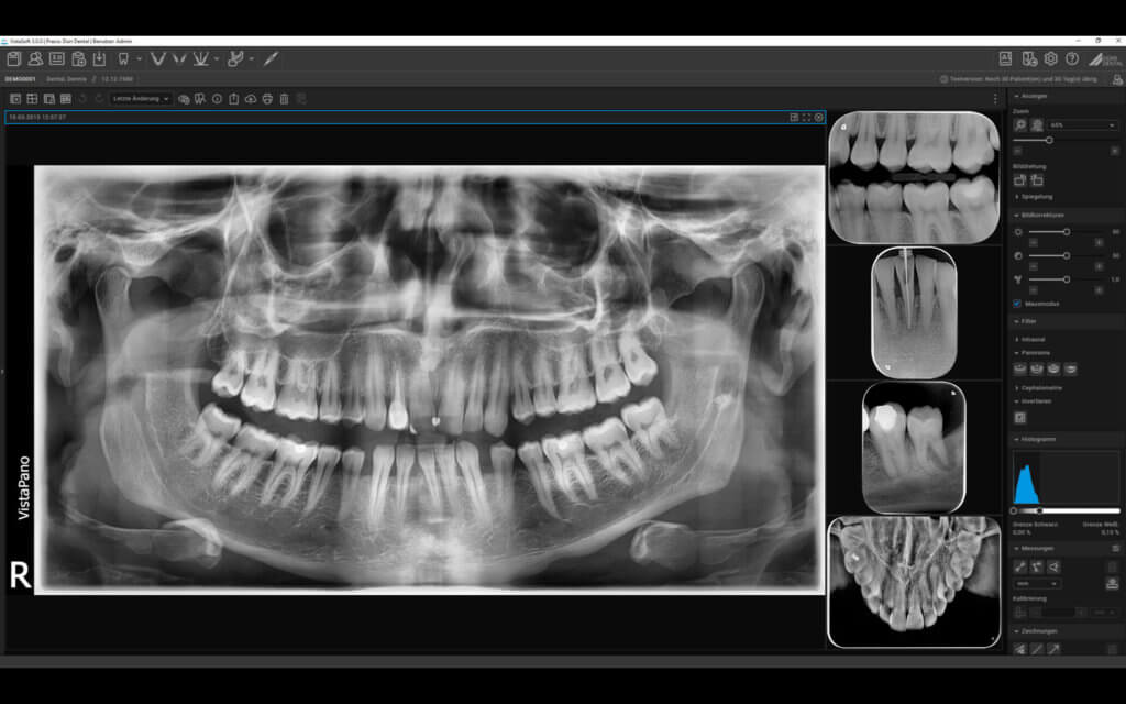 everydent-durr-dental-vistasoft-ai-05