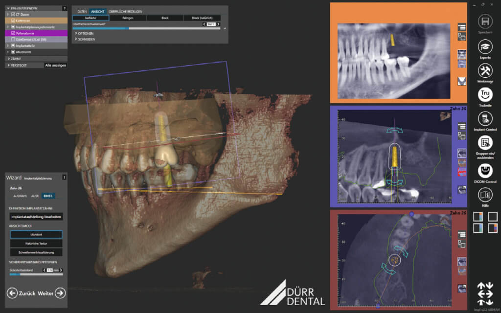 everydent-durr-dental-vistasoft-ai-07