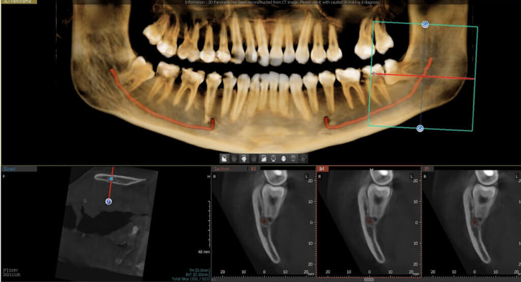 everydent-vatech-3d-snimky-01