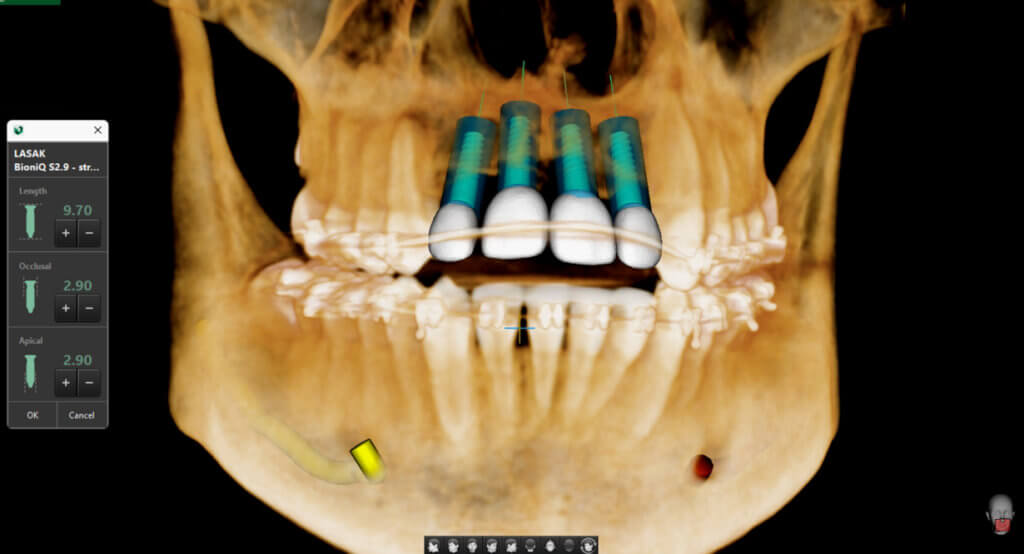 everydent-vatech-3d-snimky-02
