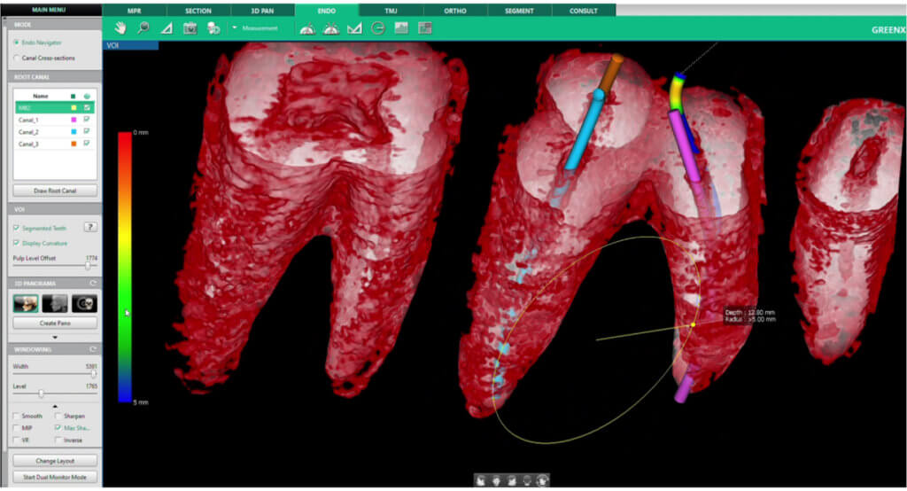 everydent-vatech-3d-snimky-03