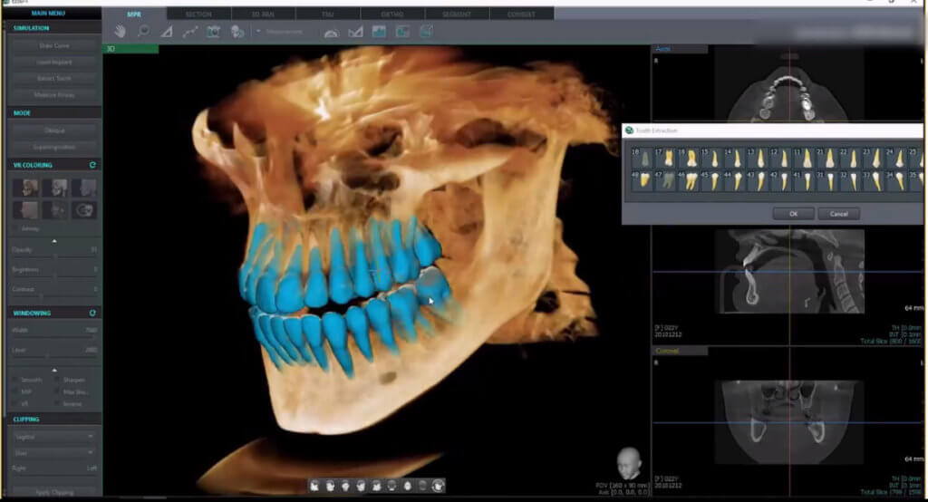 everydent-vatech-3d-snimky-04