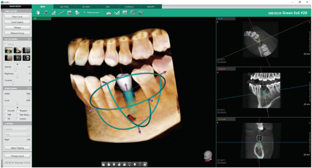 everydent-vatech-3d-snimky-05