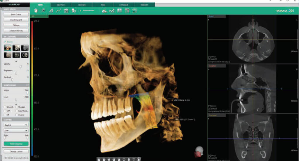 everydent-vatech-3d-snimky-06