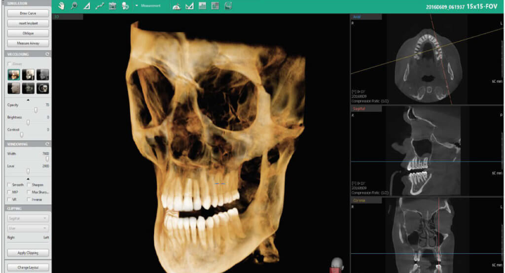 everydent-vatech-3d-snimky-07