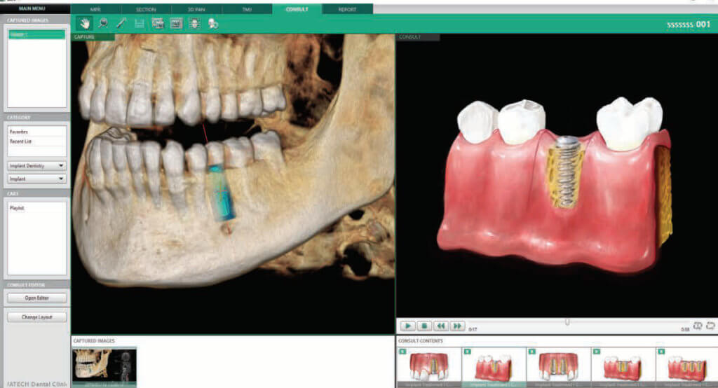 everydent-vatech-3d-snimky-08